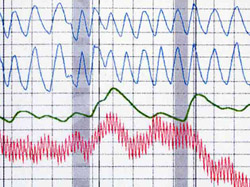 Polygraph Chart Paper